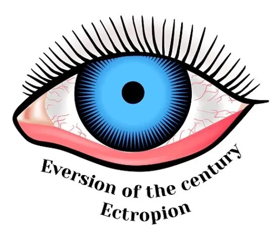 Eyelid Turns Outwards