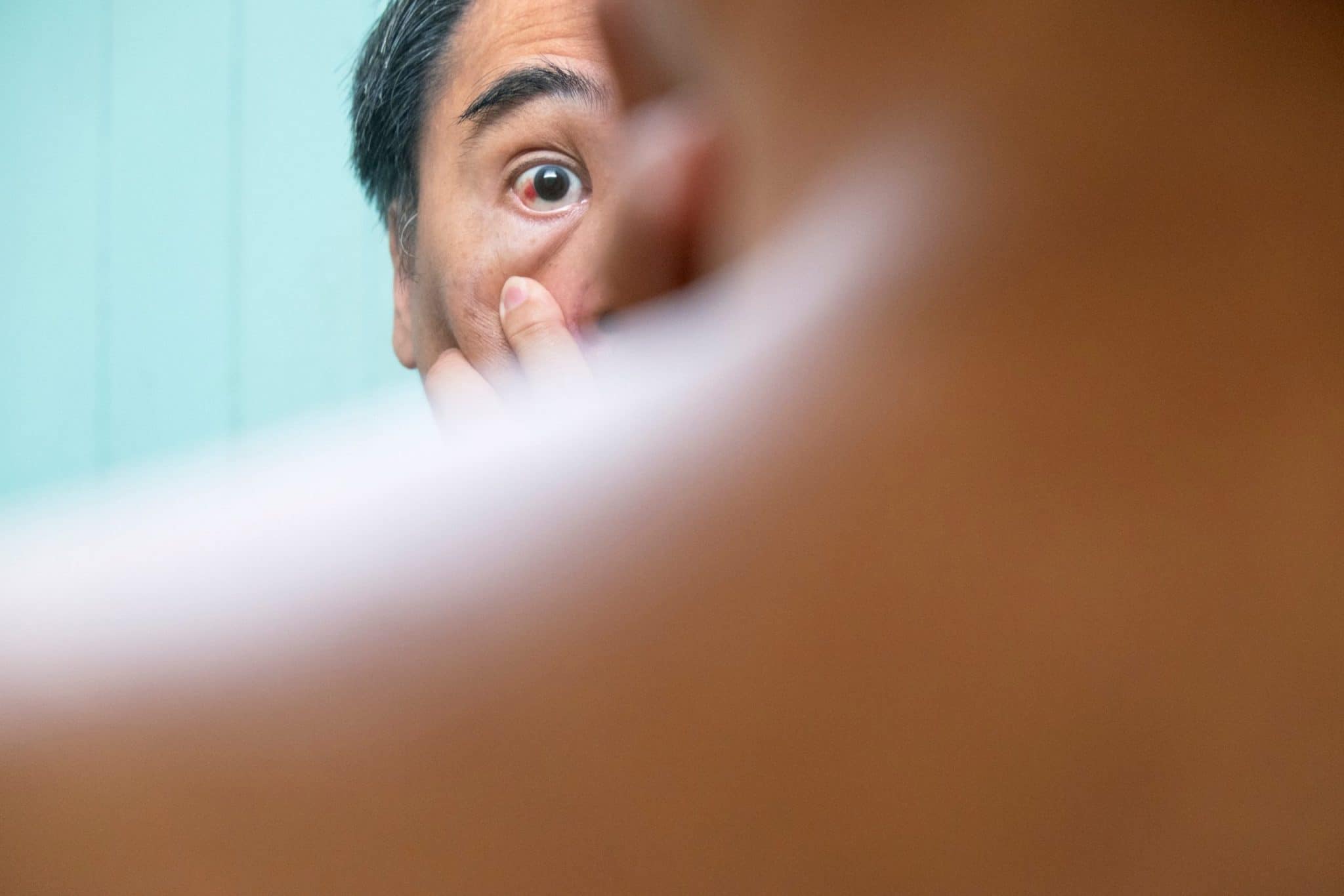 Close Up Of An Adult Man Checking Eye Redness In F HQYT3EJ Scaled (1)